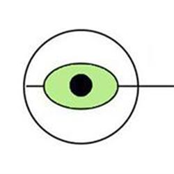 C-optik Synklinik