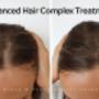 Advanced Hair Complex treatment