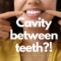 Cavity between teeth-Gloss & Floss