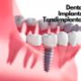 Dental Implant in Stockholm Gloss & Floss Dental Care®