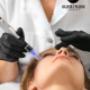 Facial Microneedling Gloss & Floss