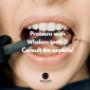 Problem with Wisdom teeth! Consult the experts!