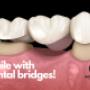 Smile with dental bridges