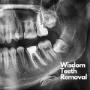 Wisdom Teeth Removal