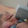 Permanent Hårborttagning DioFiber