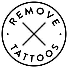 Remove Tattoos